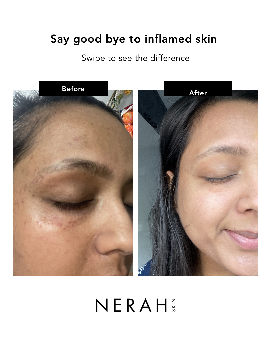 Nameko Hydrating Serum