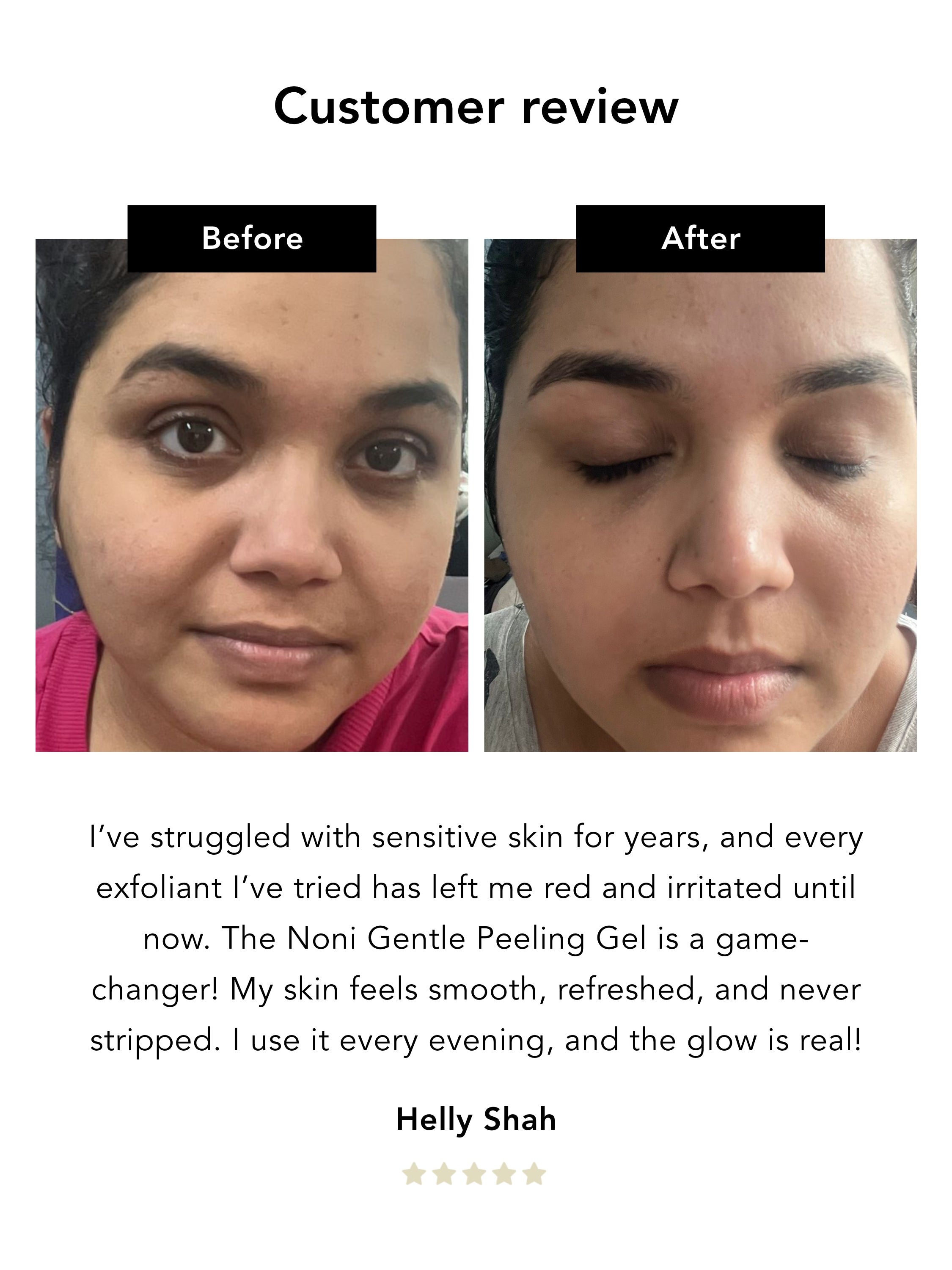 Noni Gentle Peeling Gel