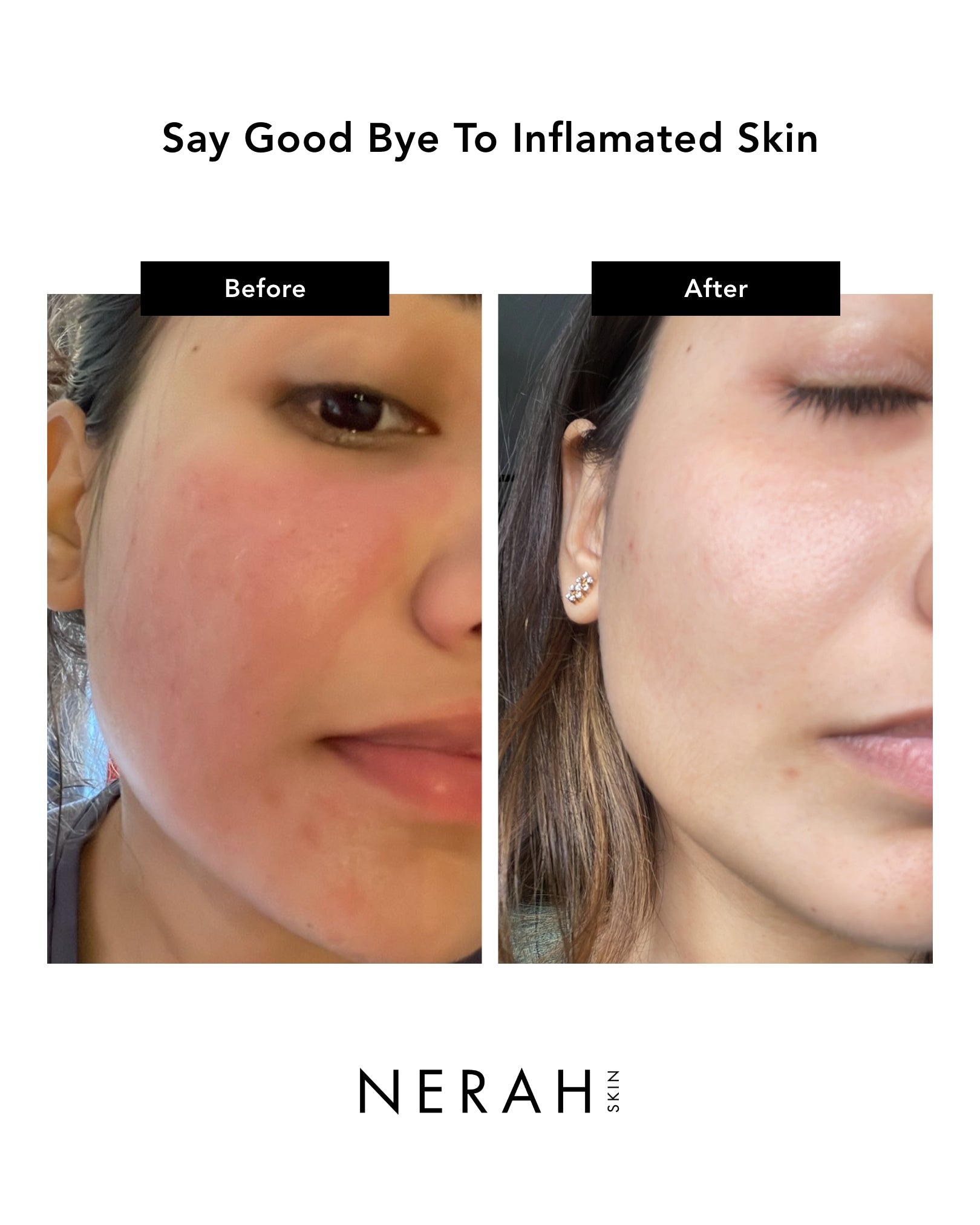 Nameko Hydrating Serum