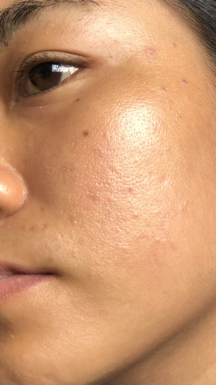 What really happens to your skin during the rainy season?