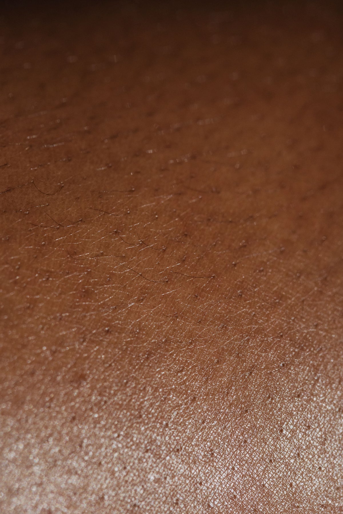 What Is the skin barrier? A simple guide to understanding your skin