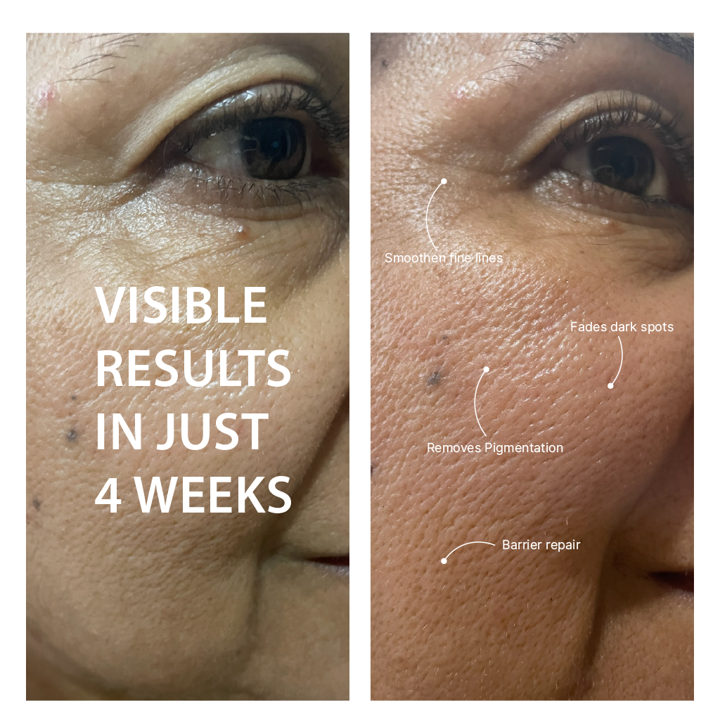 Kudzu Restoring Serum