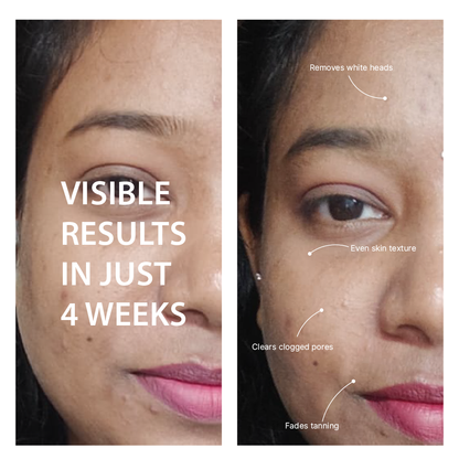 Noni Gentle Peeling Gel