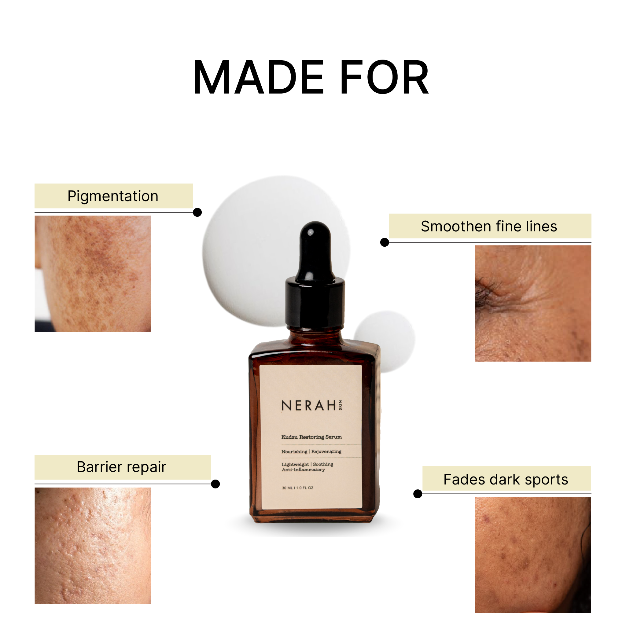 Kudzu Restoring Serum I For pigmentation, fine lines &amp; damaged barrier